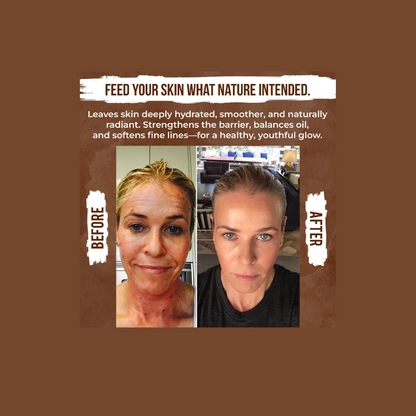 M.D KLEAN  NEW WHIPPED Beef Tallow Cream with Castor Oil and Frankincense  8 oz Glass Jar